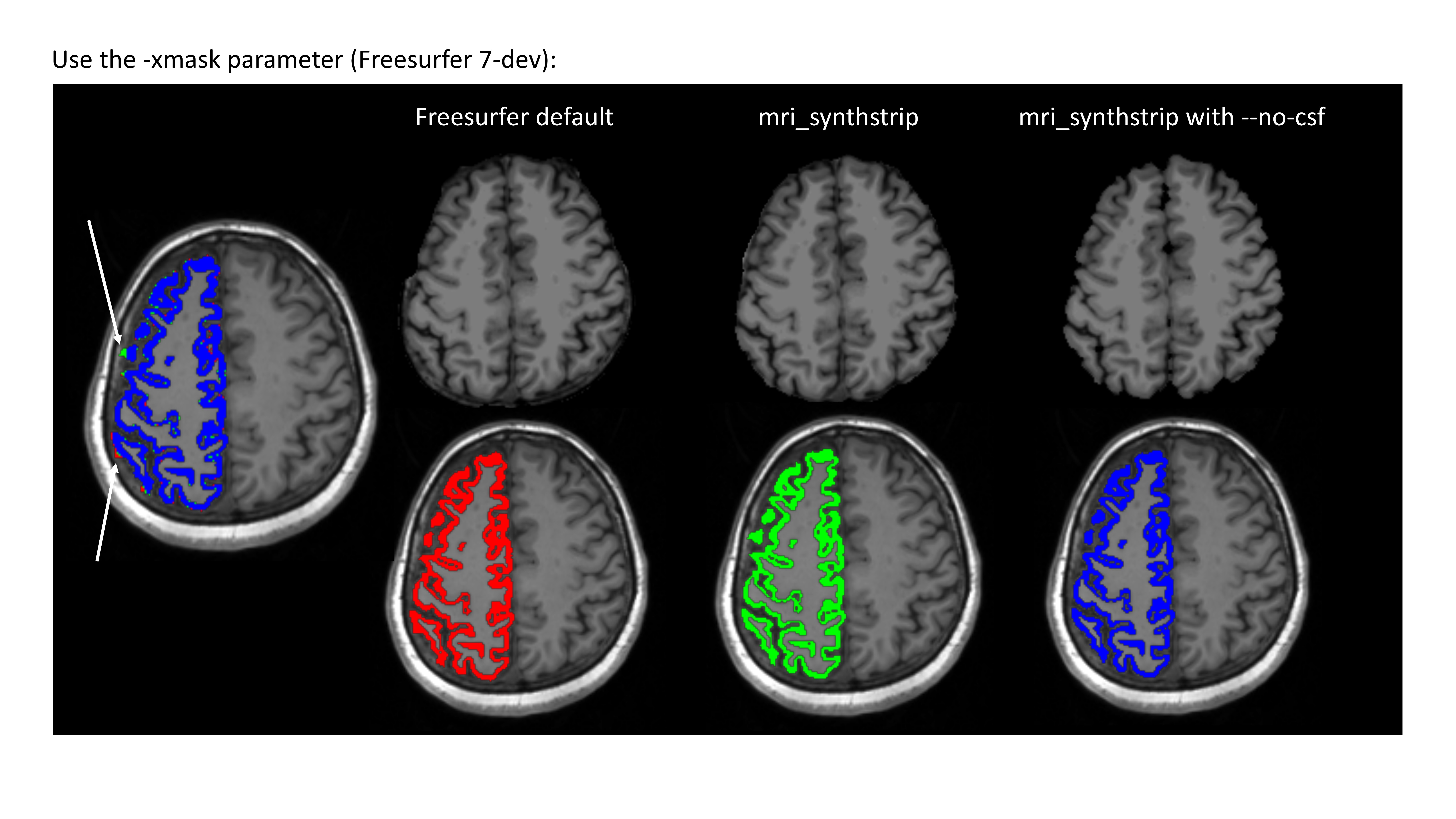 freesurfer_mask.jpg